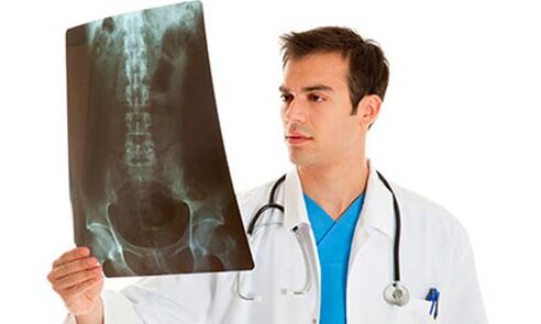 doktor bel ağrısını teşhis etmek için bir röntgene bakar